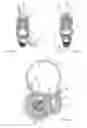 Fig. 03 - Method for producing an ornamental piece having intertwined rings