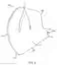 Fig. 07 - Utensil Stabilization Device