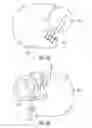 Fig. 07 - ANALYTE SENSOR WITH INDICATORS