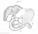 Fig. 08 - METHOD FOR COLLECTING TISSUE