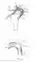 Fig. 06 - Methods and apparatus for joint distraction