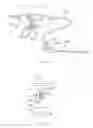 Fig. 41 - Methods and apparatus for joint distraction