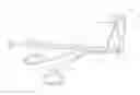 Fig. 01 - Apparatus for irrigating the vas deferens