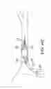 Fig. 49 - Clot retrieval system