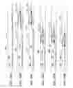 Fig. 77 - Clot retrieval system
