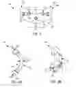 Fig. 02 - Lamina implants and methods for spinal decompression
