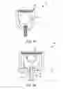 Fig. 06 - Lamina implants and methods for spinal decompression
