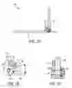Fig. 08 - Lamina implants and methods for spinal decompression
