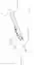 Fig. 08 - Electrosurgical device with vacuum port