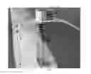 Fig. 01 - FIXATION SYSTEM
