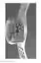 Fig. 16 - FIXATION SYSTEM