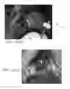 Fig. 33 - FIXATION SYSTEM