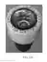 Fig. 35 - FIXATION SYSTEM