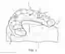 Fig. 02 - APPARATUSES AND METHODS FOR MAKING A FINAL HYBRID PROSTHESIS TO BE ATTACHED TO DENTAL IMPLANTS