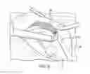 Fig. 07 - APPARATUSES AND METHODS FOR MAKING A FINAL HYBRID PROSTHESIS TO BE ATTACHED TO DENTAL IMPLANTS