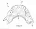 Fig. 09 - APPARATUSES AND METHODS FOR MAKING A FINAL HYBRID PROSTHESIS TO BE ATTACHED TO DENTAL IMPLANTS