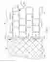 Fig. 04 - Implantable medical device with reduced migration capabilities