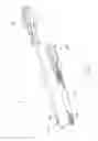 Fig. 02 - Tenodesis implants and tools