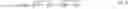 Fig. 03 - Multifocal intraocular lens with extended depth of field