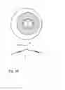 Fig. 07 - Multifocal intraocular lens with extended depth of field