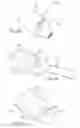 Fig. 09 - Trans-aortic delivery system with containment capsule centering device