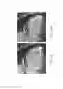 Fig. 51 - Systems and methods for improving cardiac function