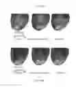 Fig. 54 - Systems and methods for improving cardiac function