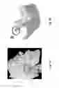 Fig. 02 - Tissue engineering system for making personalized bone graft