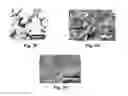 Fig. 09 - Tissue engineering system for making personalized bone graft