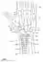 Fig. 08 - METHOD AND APPARATUS FOR WRIST ARTHROPLASTY