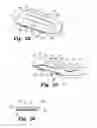 Fig. 33 - Expandable interbody fusion device