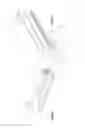 Fig. 06 - Surgical insertion instruments