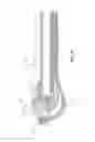 Fig. 19 - Surgical insertion instruments
