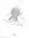 Fig. 09 - Advanced Fitment of Prosthetic Devices