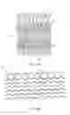 Fig. 07 - Uncaging stent