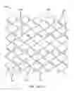 Fig. 33 - Uncaging stent