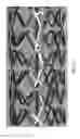 Fig. 70 - Uncaging stent