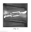 Fig. 71 - Uncaging stent
