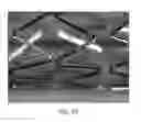 Fig. 74 - Uncaging stent