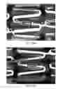Fig. 75 - Uncaging stent