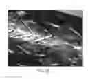 Fig. 76 - Uncaging stent