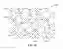 Fig. 89 - Uncaging stent