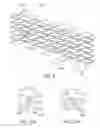 Fig. 98 - Uncaging stent