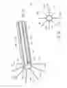 Fig. 06 - STENT DEPLOYMENT SYSTEM INCLUDING MULTIPLE STENT-ENGAGING ELEMENTS