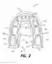 Fig. 03 - Removable mandibular myo-stimulator