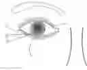 Fig. 01 - Single operator device for delivering an ocular implant