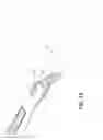 Fig. 09 - Single operator device for delivering an ocular implant
