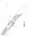 Fig. 10 - Single operator device for delivering an ocular implant