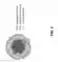 Fig. 07 - Pressure-sensing negative pressure therapy sponges and methods for the creation and use thereof