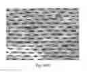 Fig. 46 - ABSORBENT ARTICLES HAVING SUBSTRATES HAVING ZONAL TREATMENTS